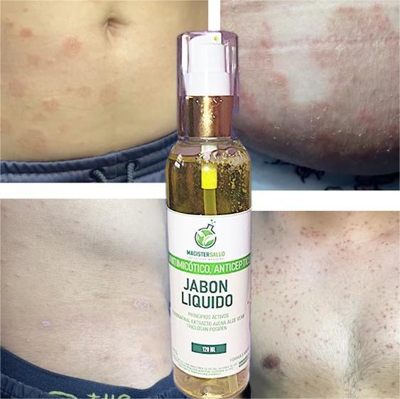 JABÓN LÍQUIDO ANTIMICÓTICO -