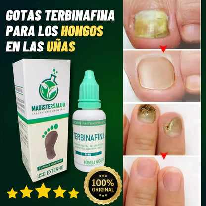 GOTAS DE TERBINAFINA PARA LOS HONGOS EN LAS UÑAS😍🦶