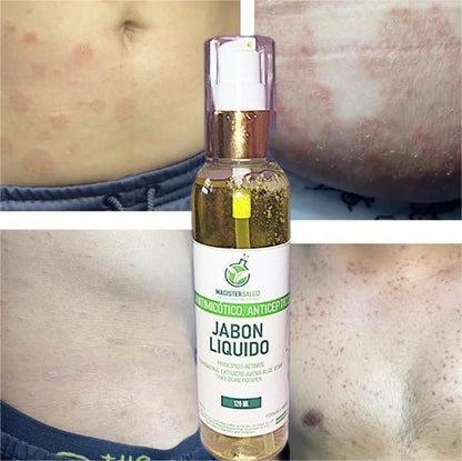 JABÓN LÍQUIDO ANTIMICÓTICO -